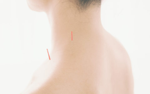肩への鍼イメージ